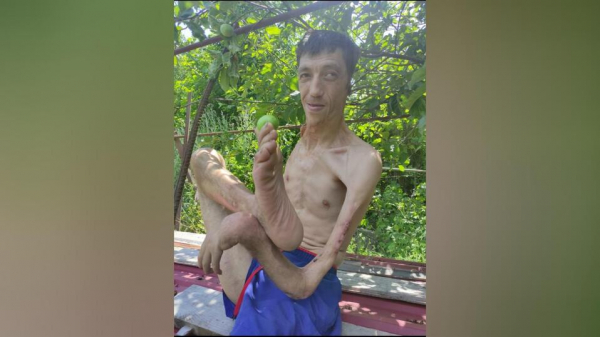 Инвалида без руки, ноги и уха отказываются освобождать из колонии